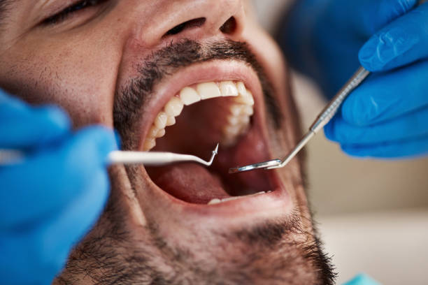Best Emergency Denture Repair in Darmstadt, IN