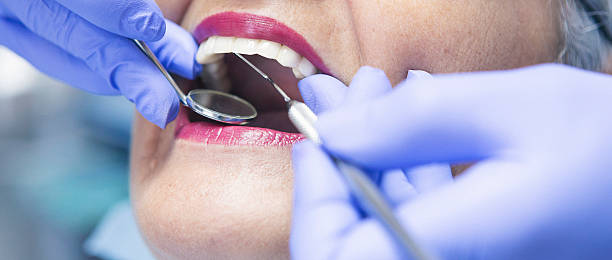 Best Emergency Dental Care for Broken or Chipped Teeth in Darmstadt, IN